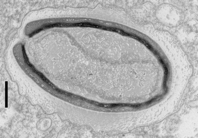 Pandoravirus Quercus (Immagine cortesia IGS- CNRS/AMU)