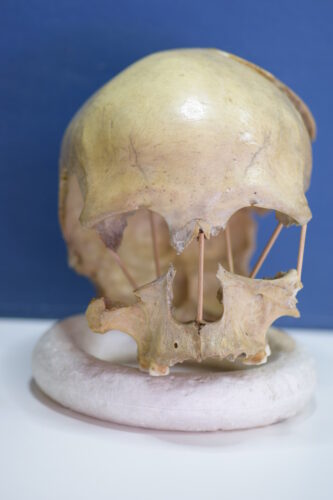 Il cranio di Pestera Muierii 1 (Foto cortesia Mattias Jakobsson)